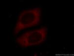 EIF3D Antibody in Immunocytochemistry (ICC/IF)