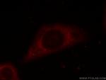 EIF3D Antibody in Immunocytochemistry (ICC/IF)
