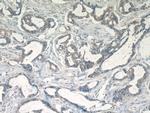 EIF3D Antibody in Immunohistochemistry (Paraffin) (IHC (P))