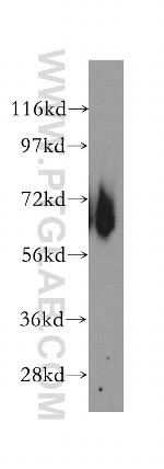 EIF3D Antibody in Western Blot (WB)