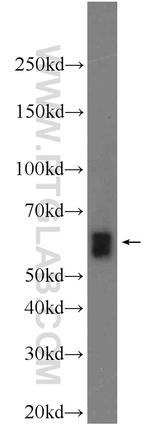 EIF3D Antibody in Western Blot (WB)