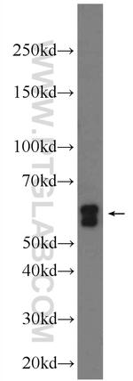 EIF3D Antibody in Western Blot (WB)