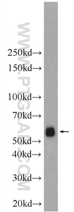 EIF3D Antibody in Western Blot (WB)