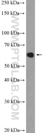 EIF3D Antibody in Western Blot (WB)