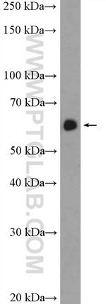 EIF3D Antibody in Western Blot (WB)