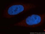 EIF3D Antibody in Immunocytochemistry (ICC/IF)