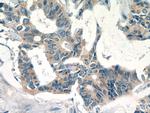 EIF3D Antibody in Immunohistochemistry (Paraffin) (IHC (P))