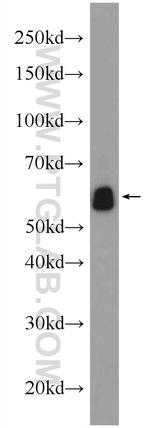 EIF3D Antibody in Western Blot (WB)