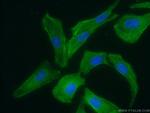 PDLIM7 Antibody in Immunocytochemistry (ICC/IF)
