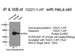 PDLIM7 Antibody in Immunoprecipitation (IP)