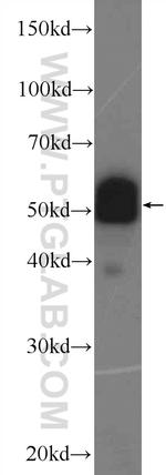 PDLIM7 Antibody in Western Blot (WB)