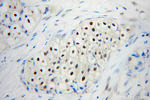 UBC9 Antibody in Immunohistochemistry (Paraffin) (IHC (P))