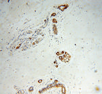 CRABP2 Antibody in Immunohistochemistry (Paraffin) (IHC (P))