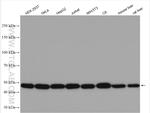 EIF2S2 Antibody in Western Blot (WB)