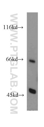 EIF2S2 Antibody in Western Blot (WB)