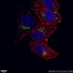 nucleobindin 1 Antibody in Immunocytochemistry (ICC/IF)