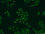 SAE1 Antibody in Immunocytochemistry (ICC/IF)