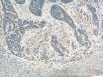 SAE1 Antibody in Immunohistochemistry (Paraffin) (IHC (P))