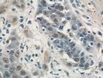 SAE1 Antibody in Immunohistochemistry (Paraffin) (IHC (P))