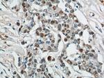 SAE1 Antibody in Immunohistochemistry (Paraffin) (IHC (P))