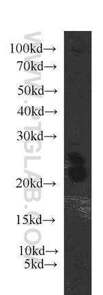 ARL2 Antibody in Western Blot (WB)
