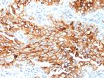 Mesothelin Monoclonal Antibody (MSLN, 2131)