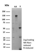 Mesothelin (Mesothelial Marker) Antibody in SDS-PAGE (SDS-PAGE)