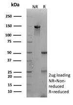 Mesothelin (Mesothelial Marker) Antibody in SDS-PAGE (SDS-PAGE)
