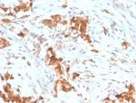 Mesothelin (Mesothelial Marker) Monoclonal Antibody (MSLN/3385)