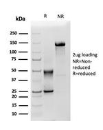 Mesothelin (Mesothelial Marker) Antibody in SDS-PAGE (SDS-PAGE)