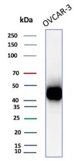 Mesothelin (Mesothelial Marker) Antibody in Western Blot (WB)