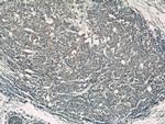 Transgelin 2 Antibody in Immunohistochemistry (Paraffin) (IHC (P))