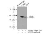 VPS35 Antibody in Immunoprecipitation (IP)