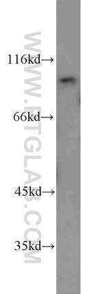 VPS35 Antibody in Western Blot (WB)