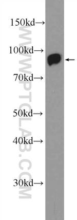 VPS35 Antibody in Western Blot (WB)