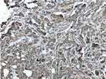 S100A11 Antibody in Immunohistochemistry (Paraffin) (IHC (P))