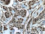 S100A11 Antibody in Immunohistochemistry (Paraffin) (IHC (P))