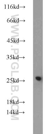 CBX1 Antibody in Western Blot (WB)