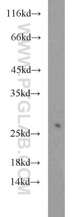 CBX1 Antibody in Western Blot (WB)