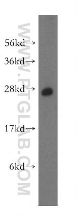 CBX1 Antibody in Western Blot (WB)