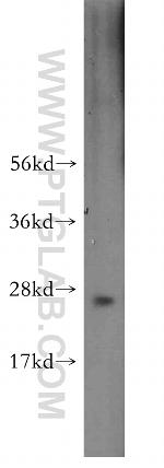 CBX1 Antibody in Western Blot (WB)