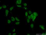 CBX1 Antibody in Immunocytochemistry (ICC/IF)