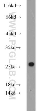 CBX1 Antibody in Western Blot (WB)