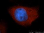 S100A6 Antibody in Immunocytochemistry (ICC/IF)