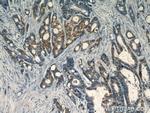 S100A6 Antibody in Immunohistochemistry (Paraffin) (IHC (P))