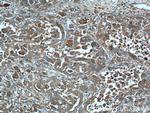 S100A6 Antibody in Immunohistochemistry (Paraffin) (IHC (P))