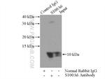 S100A6 Antibody in Immunoprecipitation (IP)