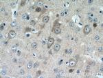 CPLX1 Antibody in Immunohistochemistry (Paraffin) (IHC (P))