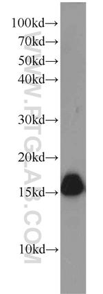 CPLX1 Antibody in Western Blot (WB)