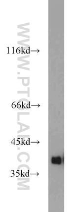 GNB1 Antibody in Western Blot (WB)